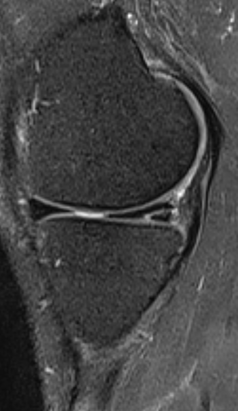 
Legend. Click for DICOM
