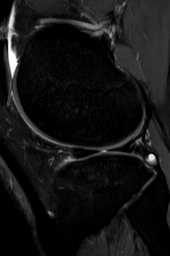 
Legend. Click for DICOM
