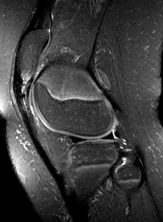 
Sindif Larsen. Click for DICOM
