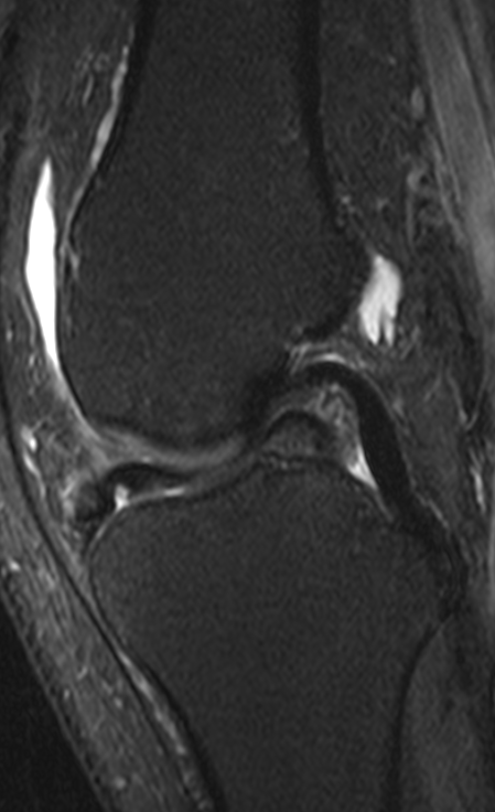 
BHT. Click for DICOM
